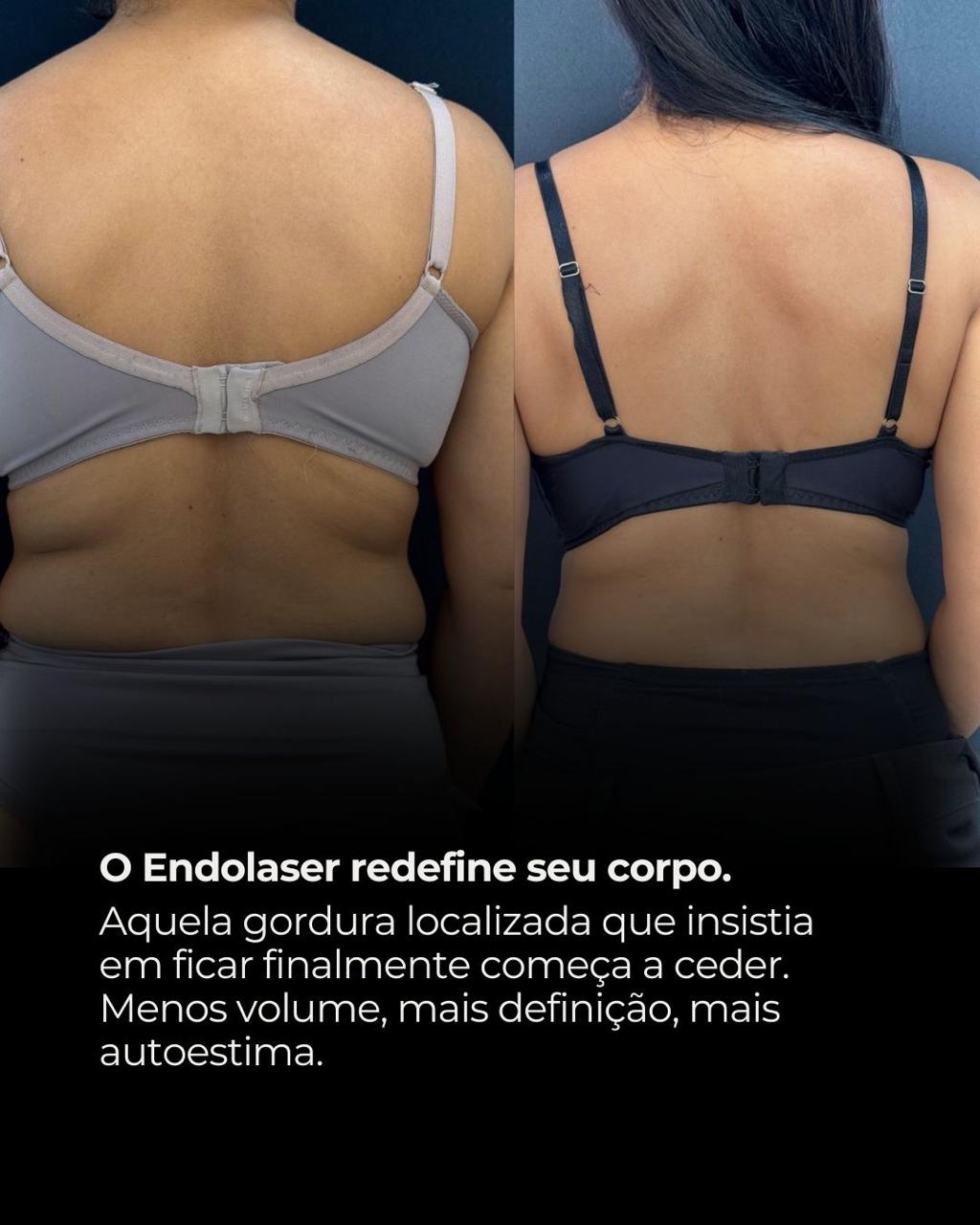 Protocolos Premium de Emagrecimento